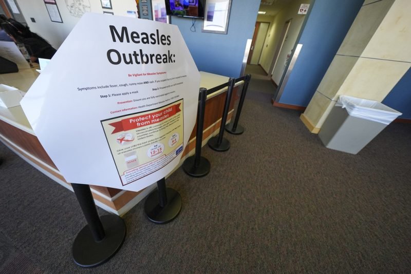 Measles confirmed in 3 more states as cases multiply