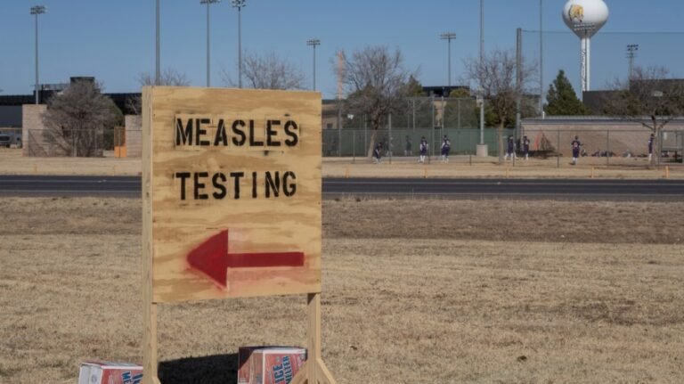 Almost 7 in 10 concerned about measles outbreak: Poll