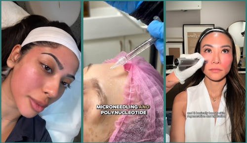 Do Salmon Sperm Facials Really Work? Skin Pros Weigh In