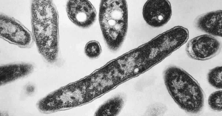 Second person dies from Legionnaires' disease in NYC