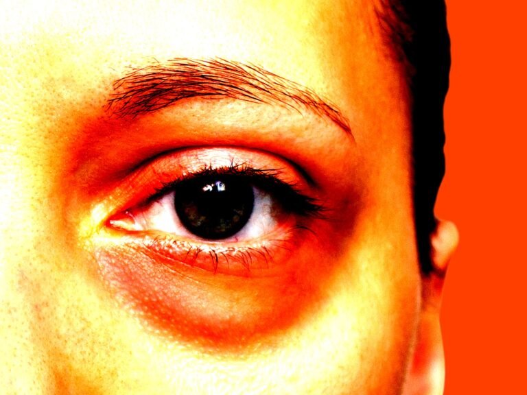 Would you spend $5,000 to remove your eye bags?