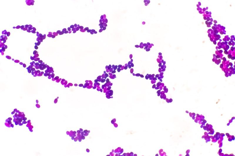 Candida auris: Study reveals who is most vulnerable to deadly fungus infection