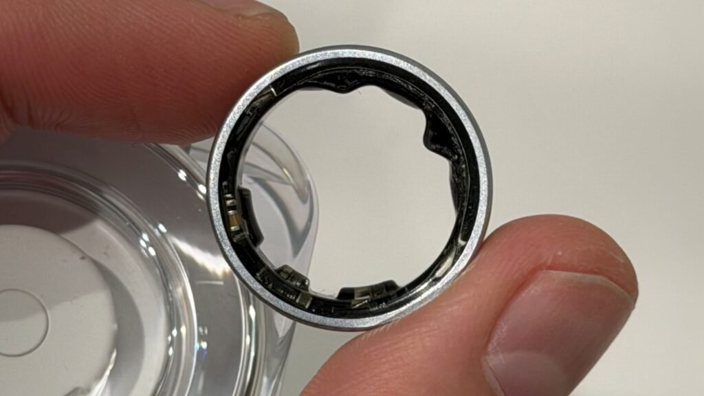 Galaxy Ring swelling victim shows aftermath and points to another case