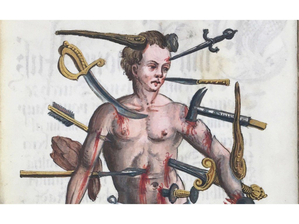 How the Wound Man Healed Medieval Europe 