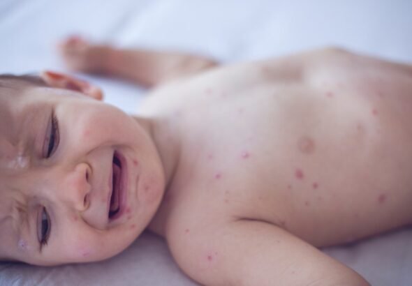 Does RFK Jr. care that babies will needlessly die under his vaccination policies?