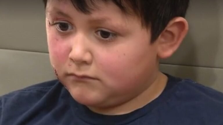 TikTok trend leaves 9-year-old boy with severe burns from microwaved 'NeeDoh' toy