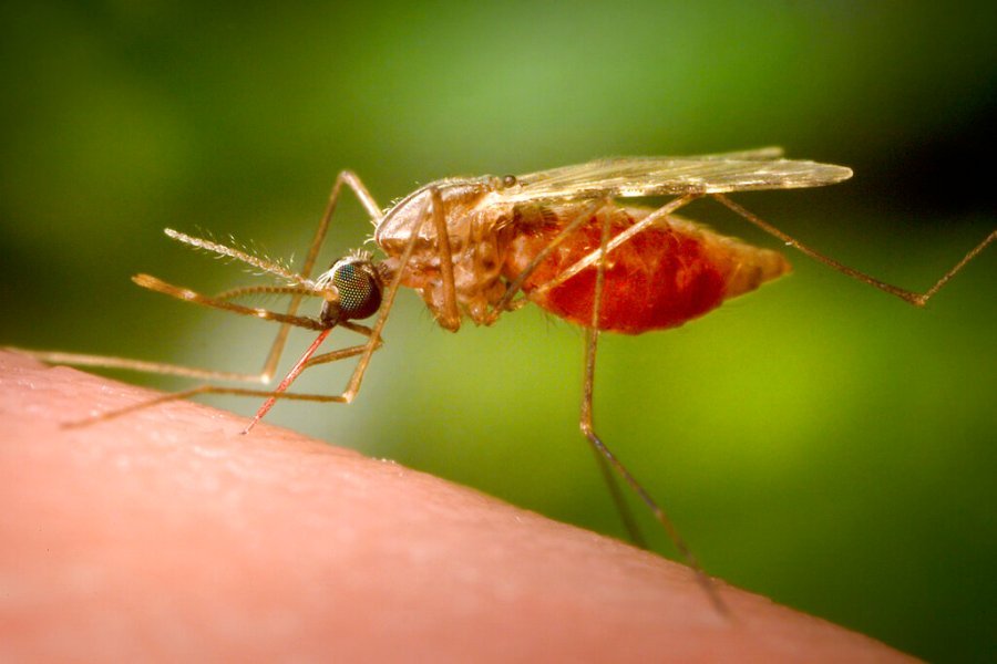 An ancient disease is making a comeback, and every American should be concerned