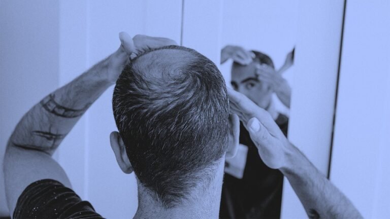 New oral drug shows success in reversing hair loss
