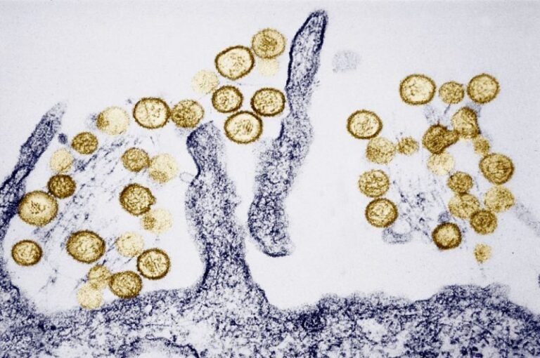 Hantavirus: Where the rare, sometimes deadly disease has been found in the US