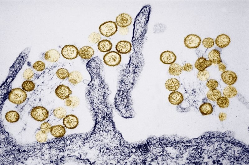 Hantavirus: Where the rare, sometimes deadly disease has been found in the US