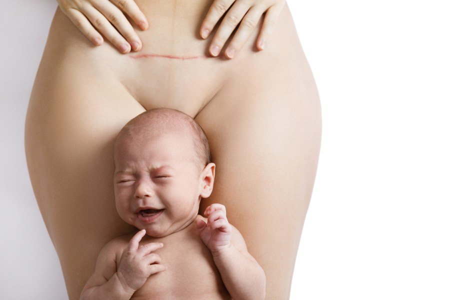 Can a woman in labor be forced to have a C-section she doesn't want? 