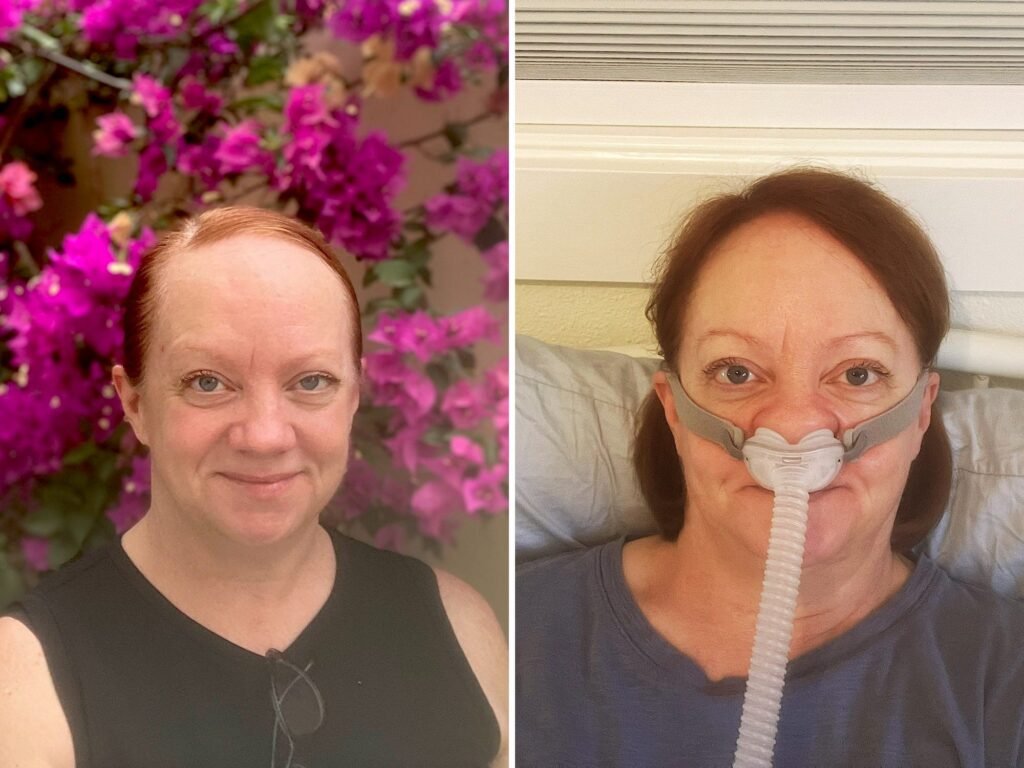 I thought I was exhausted by being a single, middle-aged parent. I learned sleep apnea was the culprit.