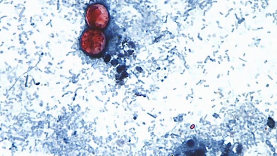 40 percent report buying less produce amid cyclospora outbreak: Poll