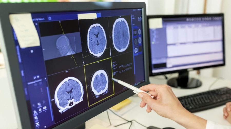 Trump administration wants to cut hospital payments for imaging 