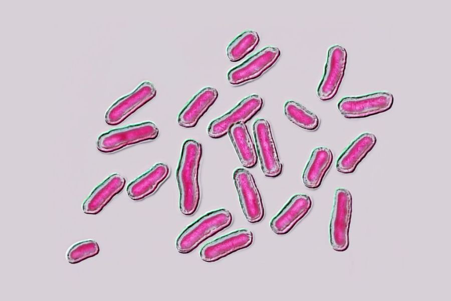 From formula to birds, here are the foodborne outbreaks the CDC is investigating