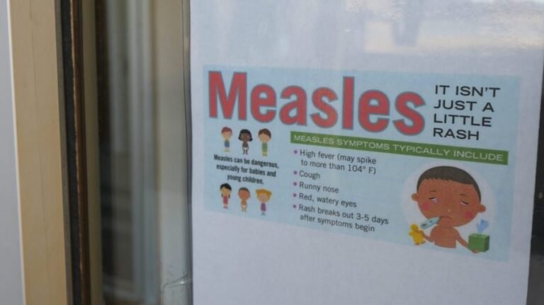 Pennsylvania woman dies from measles complications