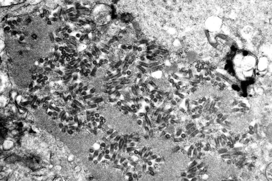 Human rabies exposure cases on the rise, CDC warns