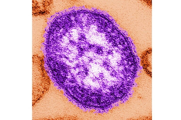 Pennsylvania reports sixth measles death