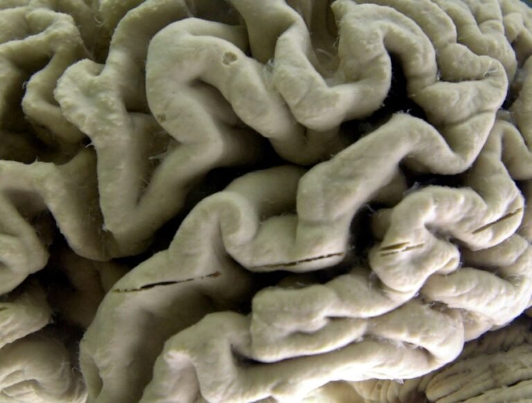 A rare healthcare issue both parties agree on: A solution to Alzheimer’s that can’t wait