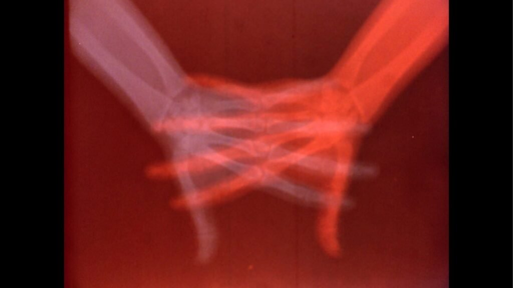 Medical Imaging and Art Meet in the Exhibition “Overexposed”